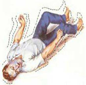 西安癫痫病治疗比较好的医院有哪